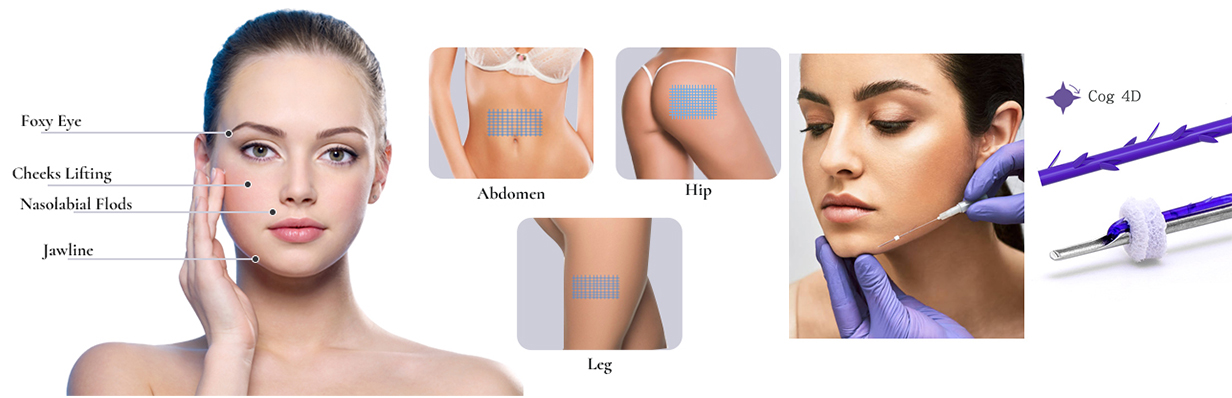 PDO Cog 4D Facial Lift : levage de fil avancé pour le contour de la mâchoire