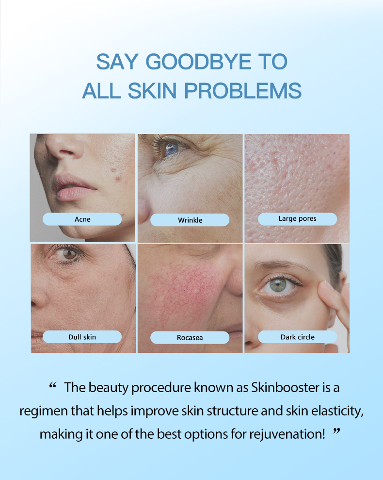 Skinbooster méso secret