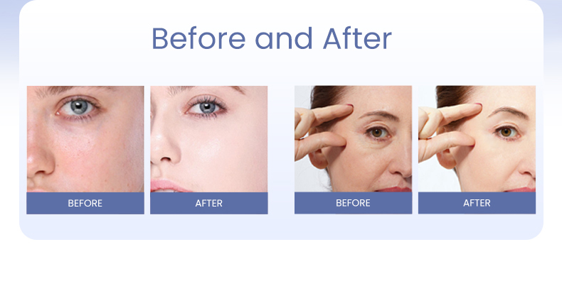 Booster de peau PDRN