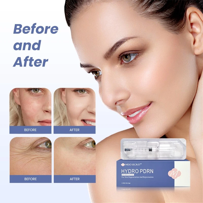 Booster de peau PDRN