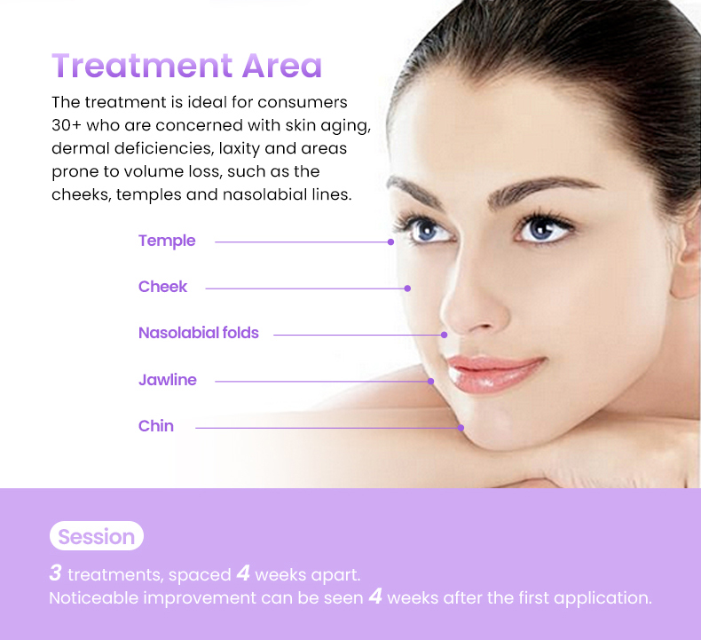 PLLA Filler