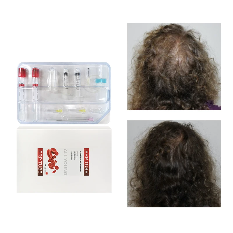 Kit cor&eacute;en de tubes PRP gel biotine ACD 15&nbsp;ML