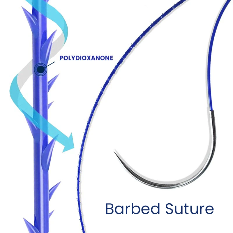 Sutures chirurgicales r&eacute;sorbables