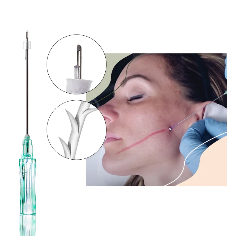 Fil de moulage PCL 18G 19G 100 mm pour le contour du visage