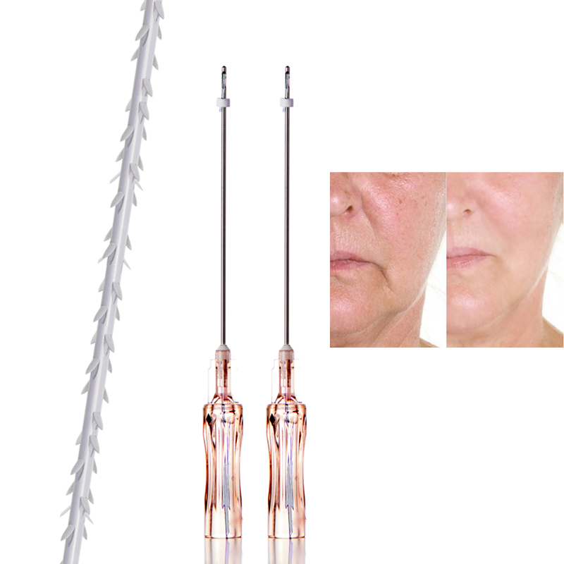 Fil barbelé bidirectionnel PLLA COG 6D, levage Max SMAS, ligne en V, Contour du visage, fil Premium
