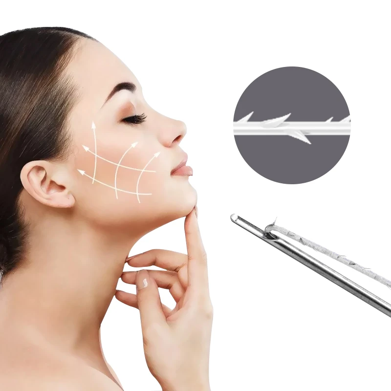 Fils PCL Cog 6D, fils forts barbel&eacute;s pour lifting du visage